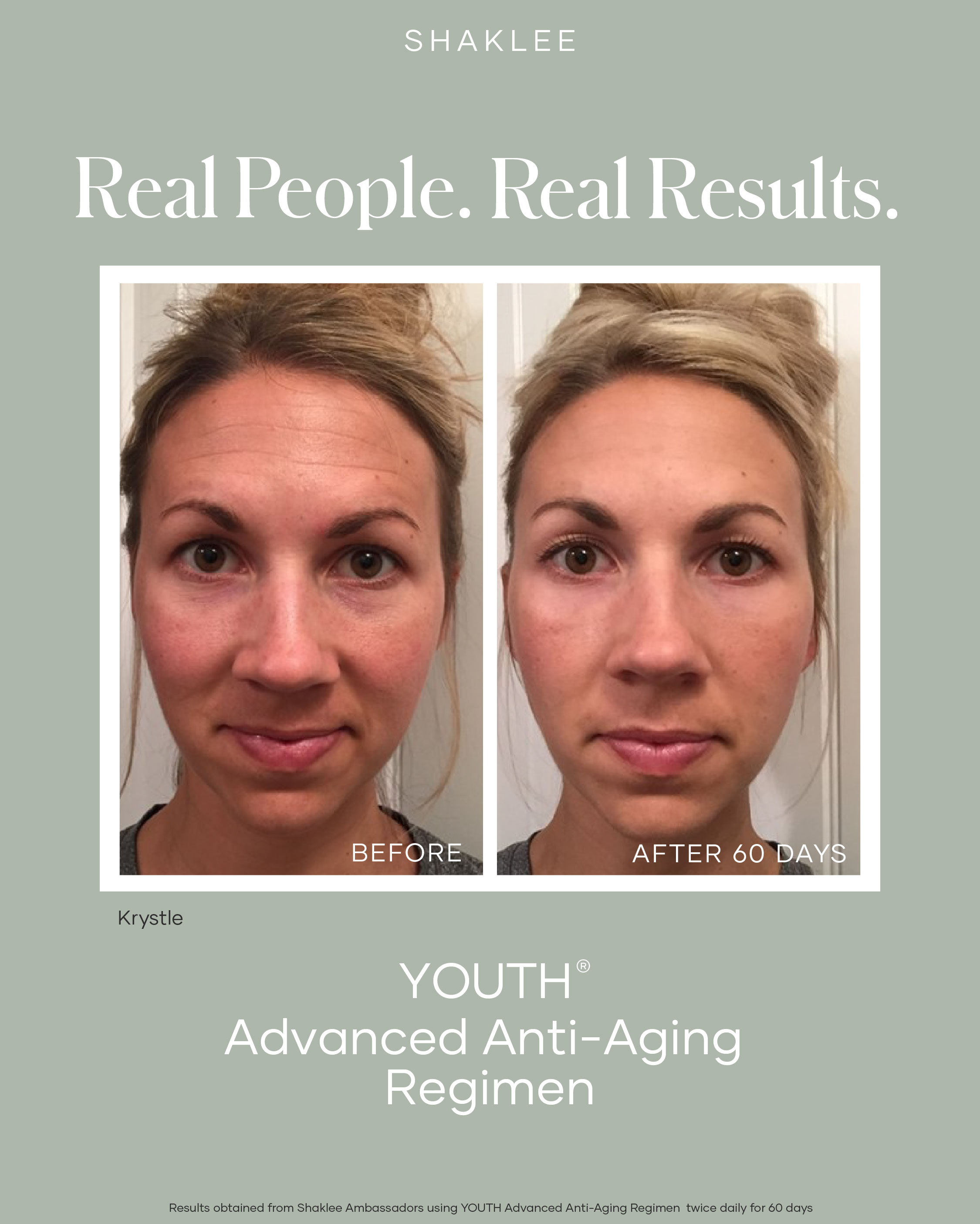 Before and after using the YOUTH Advanced Anti-Aging Regimen for 60 days